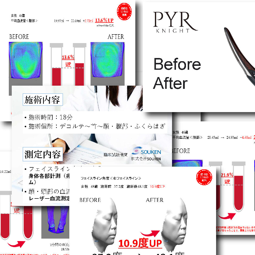 PYR-KNIGHT パイラナイト（マルチビューティーゲル付） ｜即効性が売り 